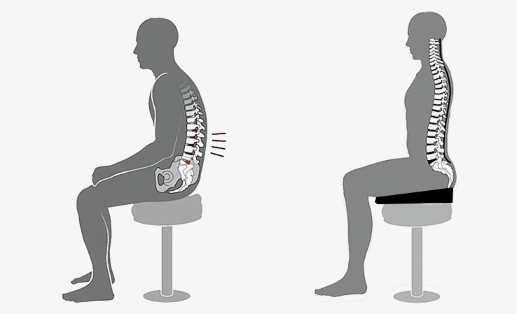 Zit tips sit on a wedge especially when you have png